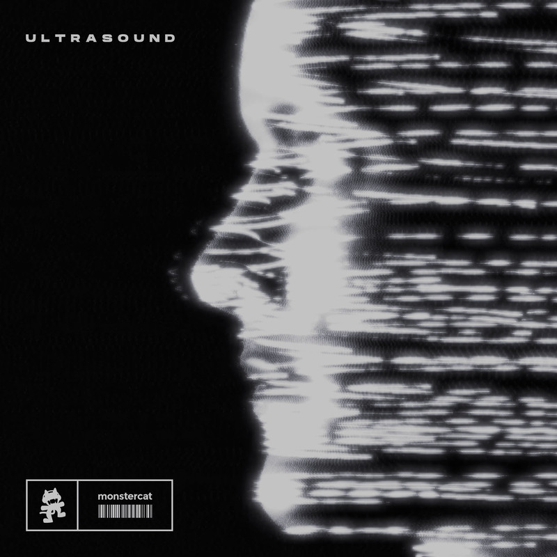 Arcando & Pirapus - Ultrasound (Original Mix)